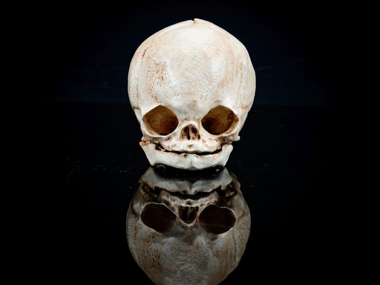 Fetal Skull with Craniosynostosis - Safety Third Studios