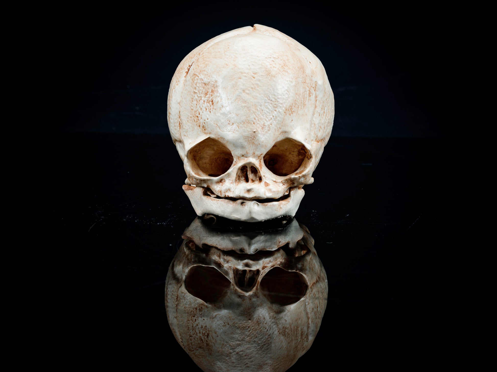 Fetal Skull with Craniosynostosis - Safety Third Studios