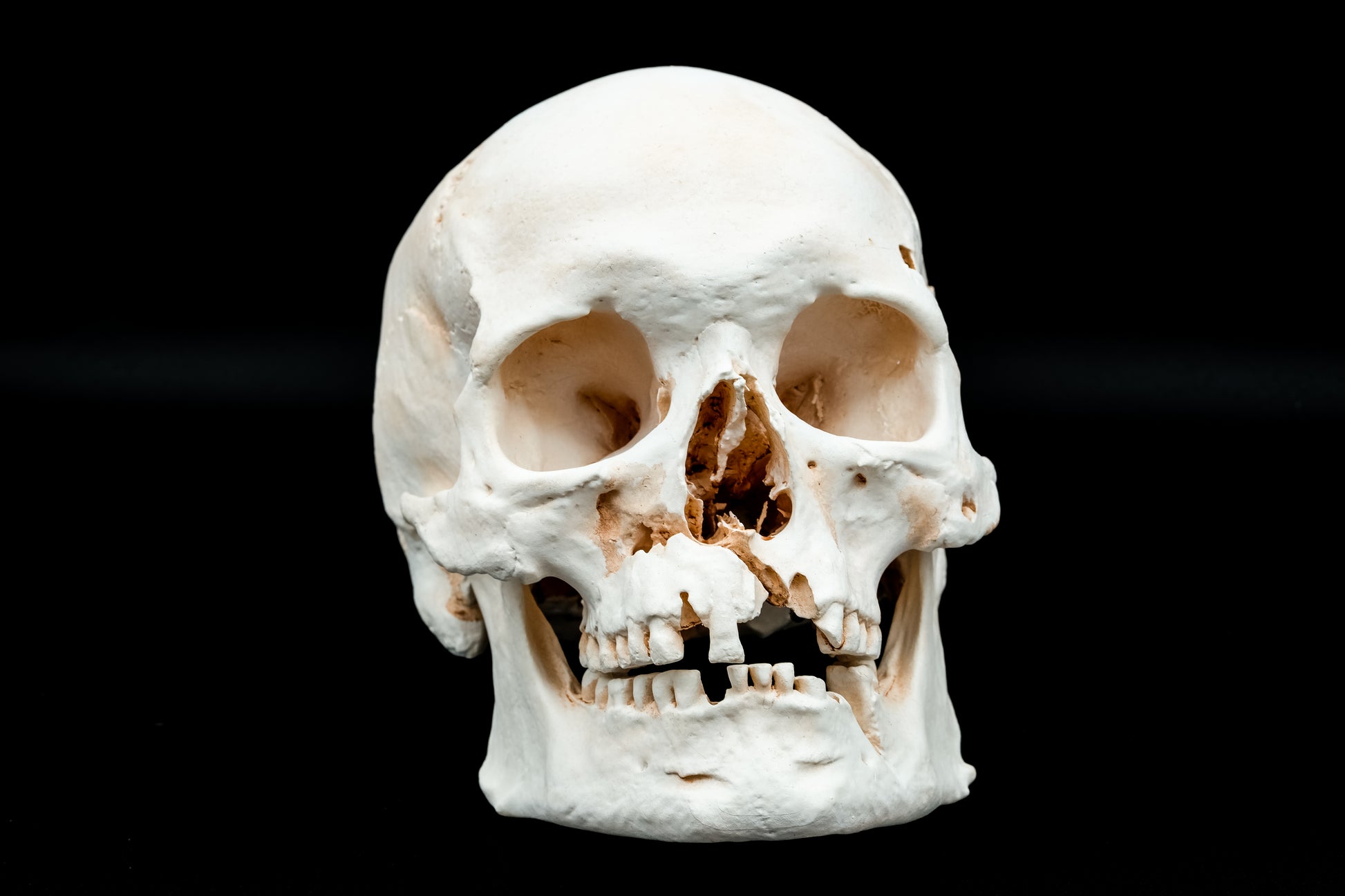 Gotland Adult Human Skull Replica - Safety Third Studios
